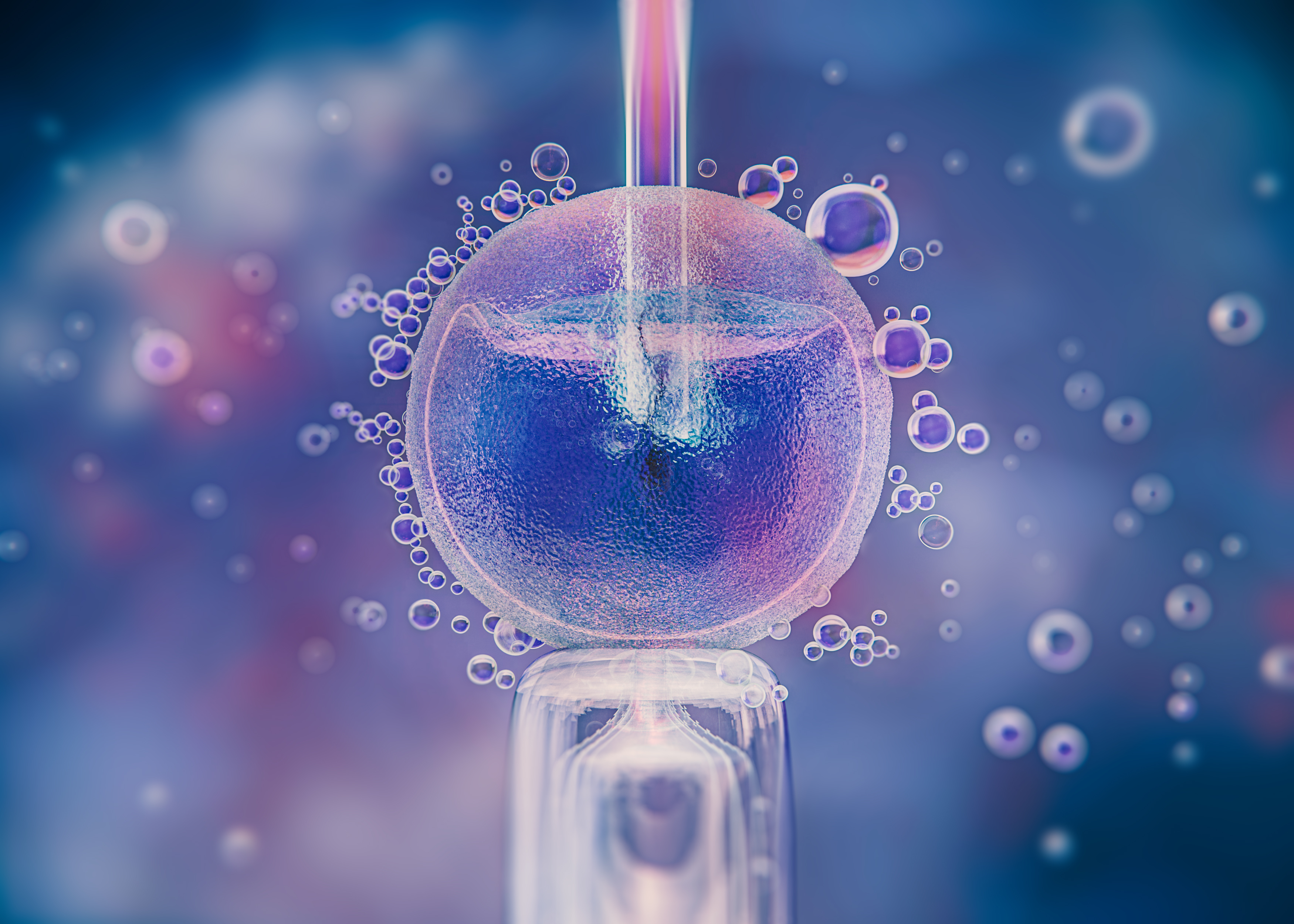 ICSI Treatment